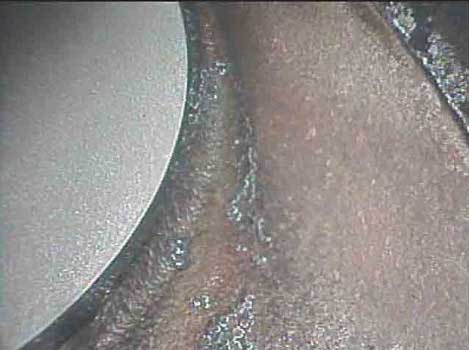 Image of small carbon deposits near the exhaust valves taken by a VJ-Advance video borescope during an automotive engine inspection