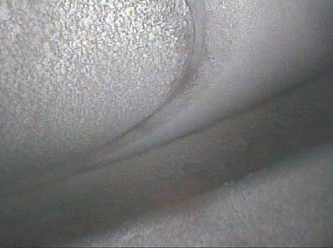 Image of an exhaust valve seat taken by a VJ-Advance video borescope during a Waukeshaw 7042 Inspection
